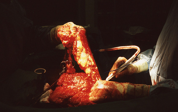 Surgery102